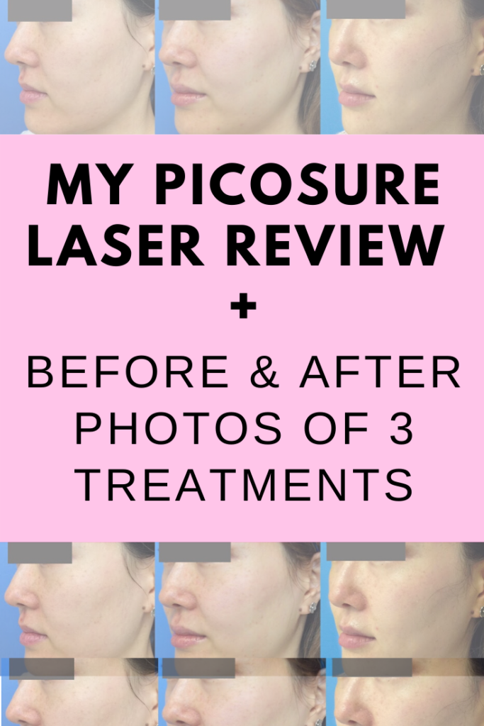 pakket effectief kan zijn PicoSure Laser Review (Before & After Photos) – ORGANIC BEAUTY LOVER