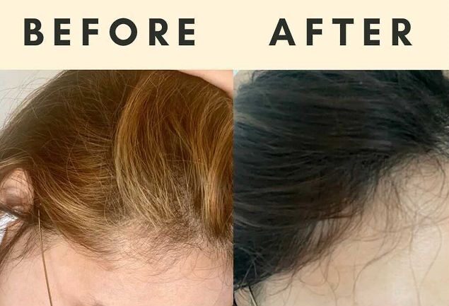 VEGAMOUR Review: Before and After Photos – ORGANIC BEAUTY LOVER