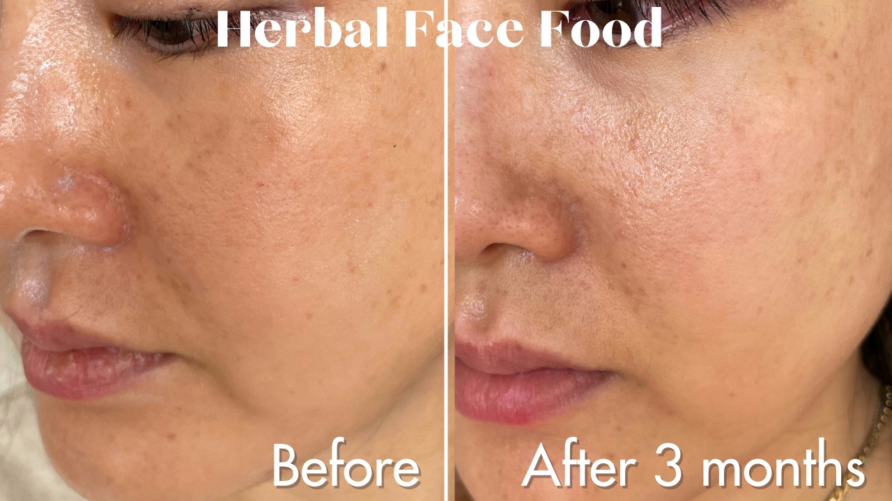 Herbal Face Food Before and After