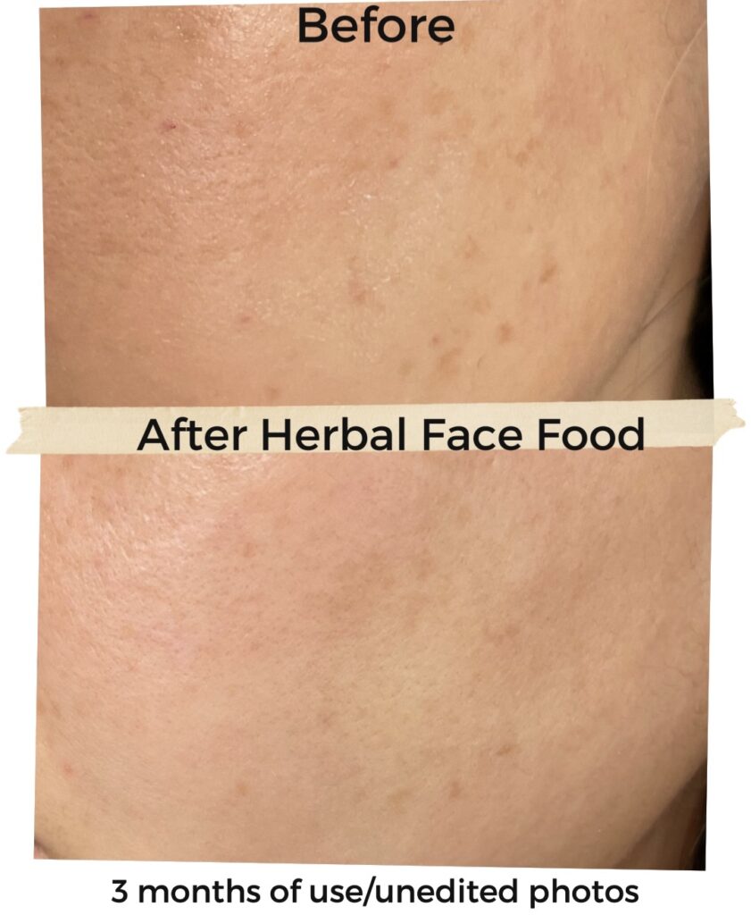 Herbal face food before after photos
