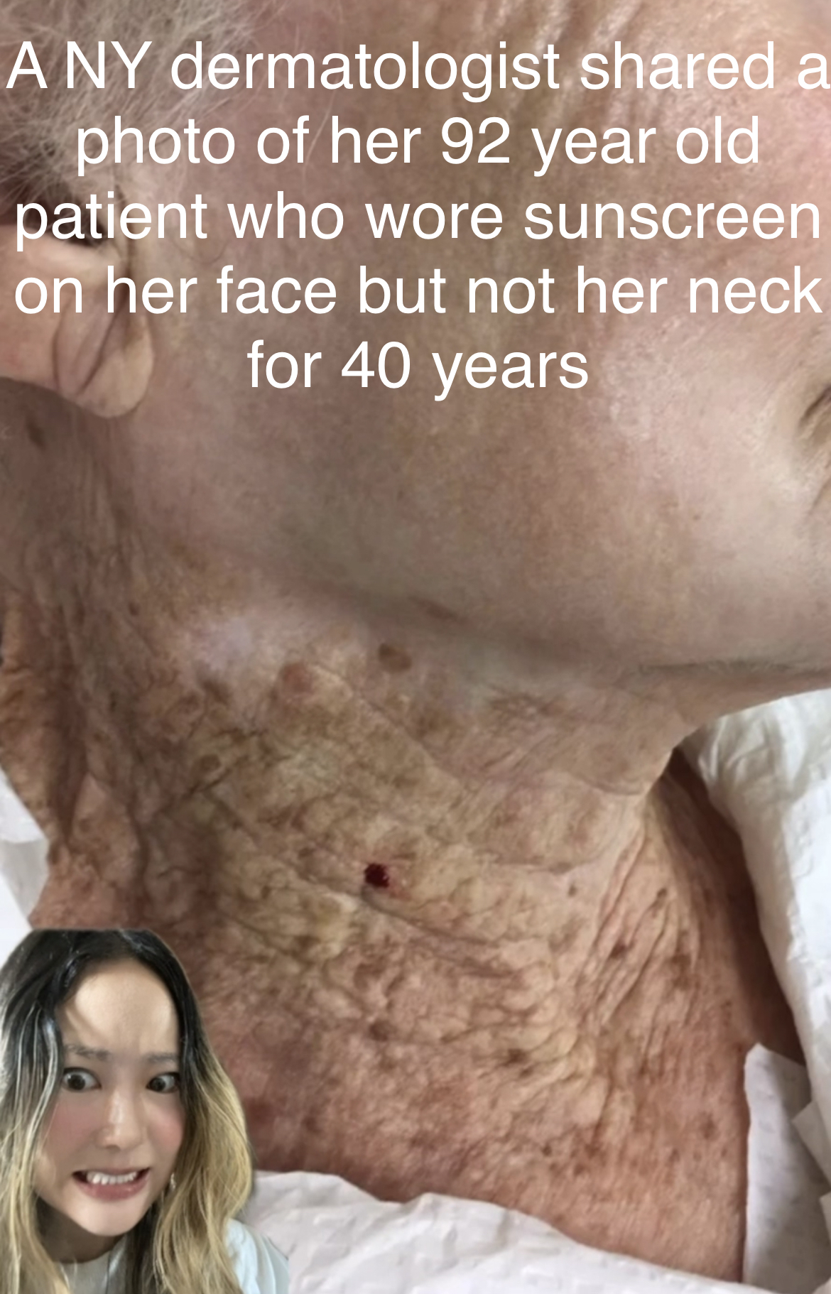 Women neck sunscreen 40 years