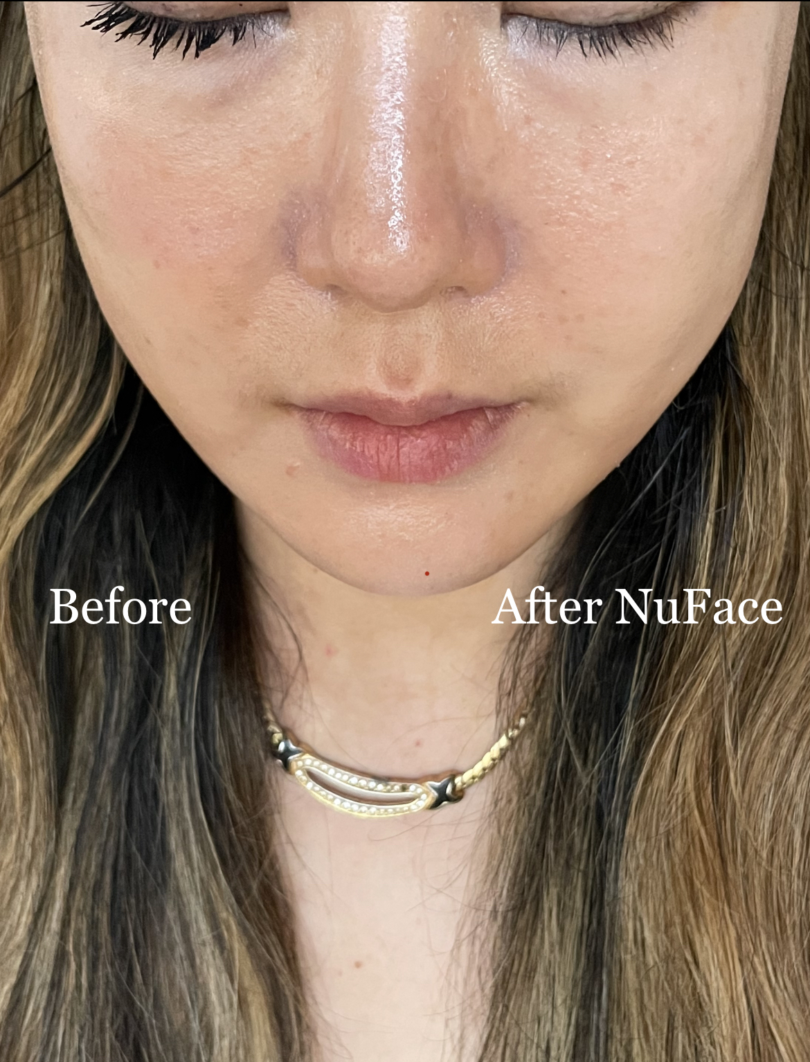 NuFace before and after