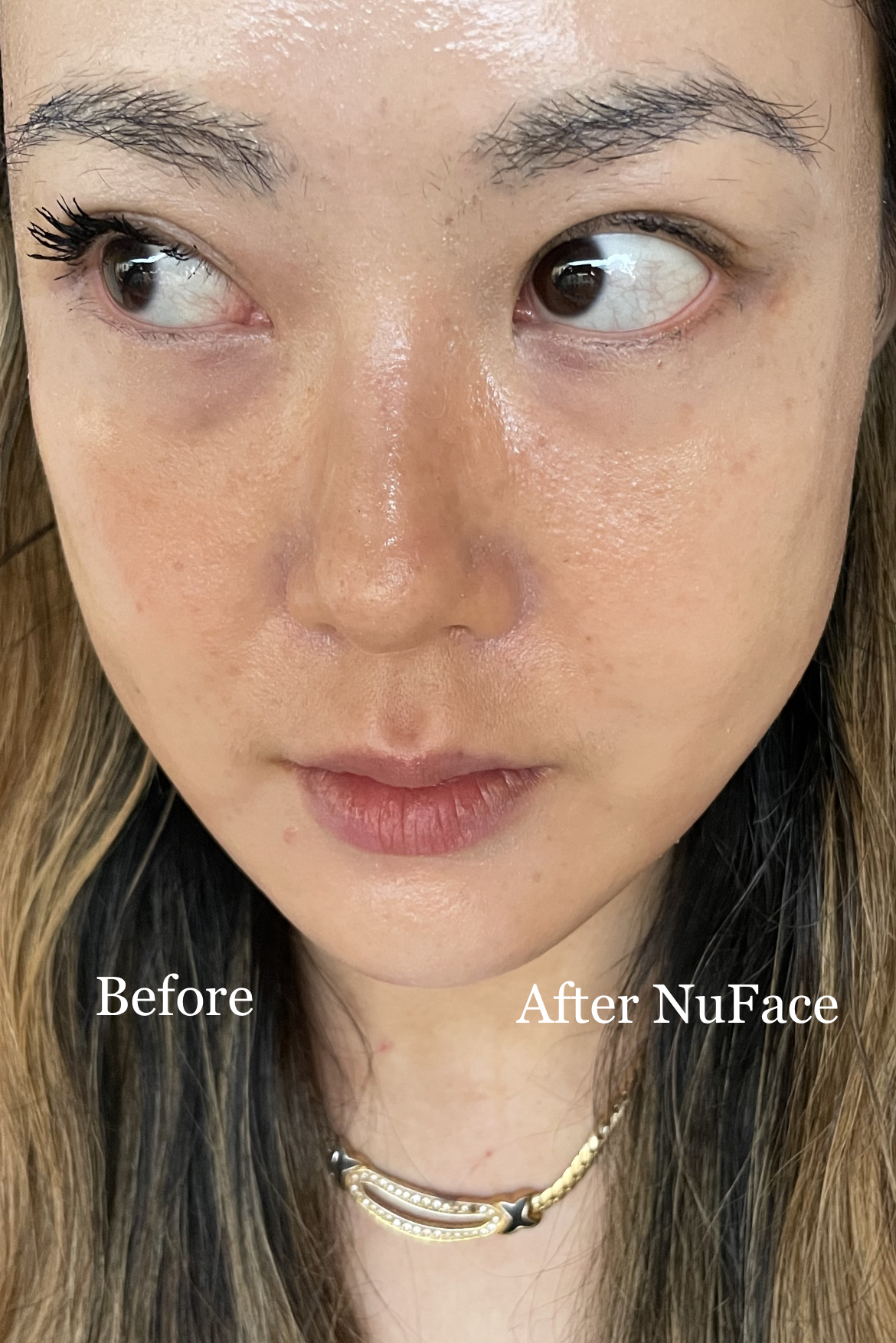 NuFace before and after photos