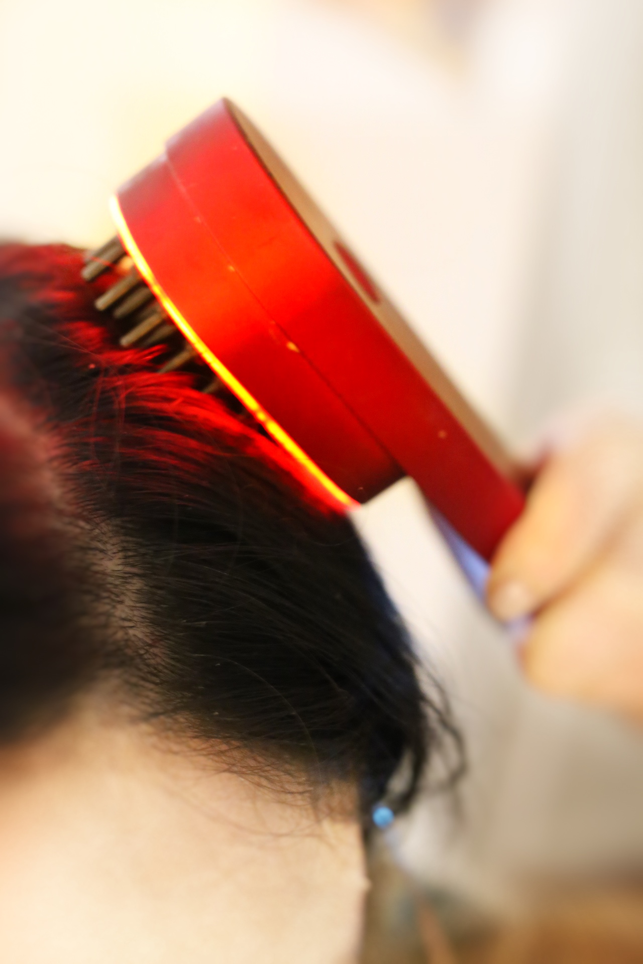 Red Light Therapy for Hair Loss VS Other Treatments