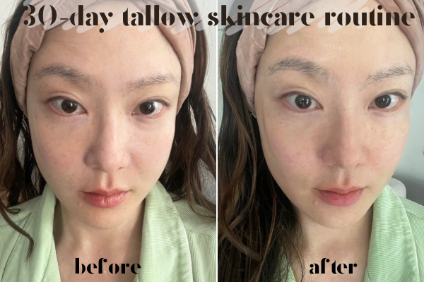 beef tallow skin care routine before and after