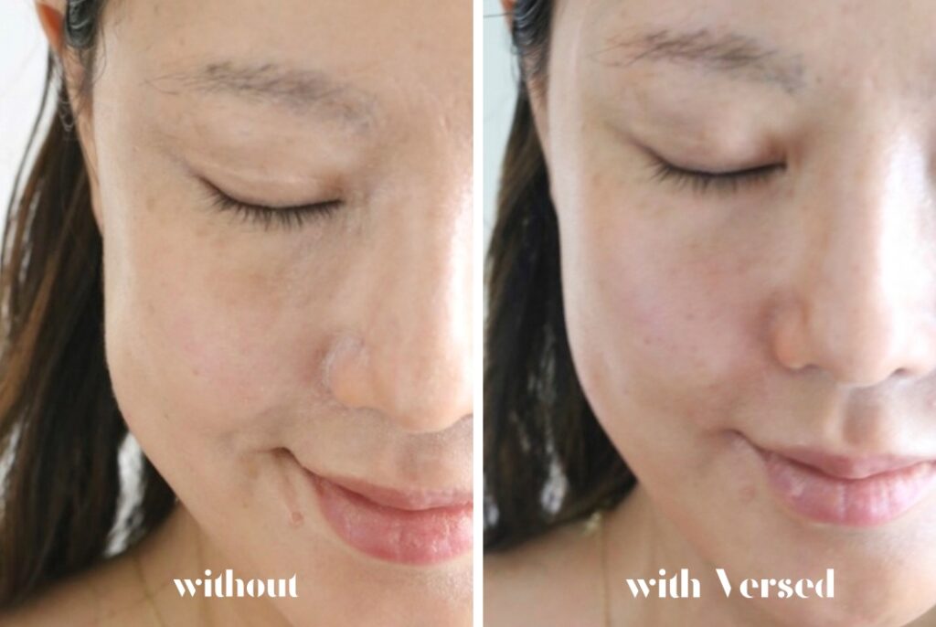 versed glow drops before and after