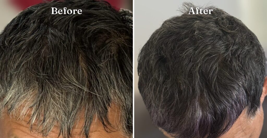 Radico Organic Hair Dye before and after