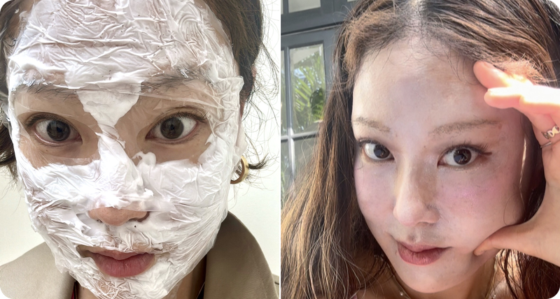 korean skincare treatment seoul korea xenia clinic gangnam